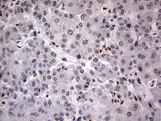 C14orf166 Antibody in Immunohistochemistry (Paraffin) (IHC (P))