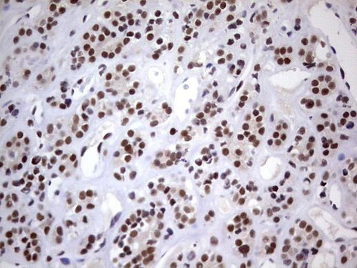 RTRAF Antibody in Immunohistochemistry (Paraffin) (IHC (P))