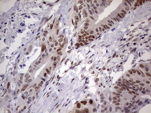 C14orf166 Antibody in Immunohistochemistry (Paraffin) (IHC (P))