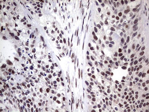 RTRAF Antibody in Immunohistochemistry (Paraffin) (IHC (P))