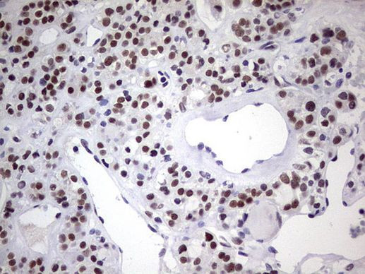 C14orf166 Antibody in Immunohistochemistry (Paraffin) (IHC (P))