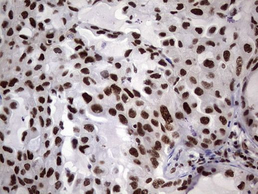 RTRAF Antibody in Immunohistochemistry (Paraffin) (IHC (P))