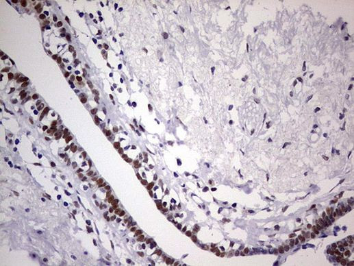 C14orf166 Antibody in Immunohistochemistry (Paraffin) (IHC (P))