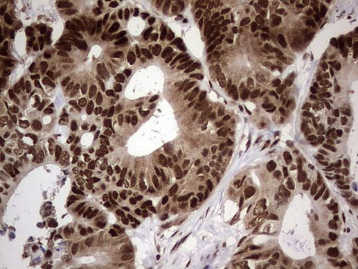 C14orf166 Antibody in Immunohistochemistry (Paraffin) (IHC (P))