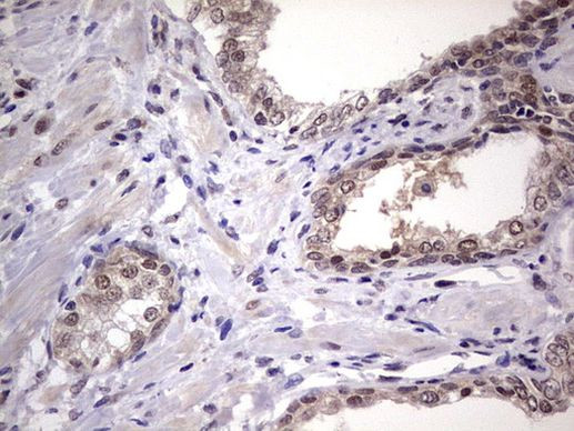 C14orf166 Antibody in Immunohistochemistry (Paraffin) (IHC (P))