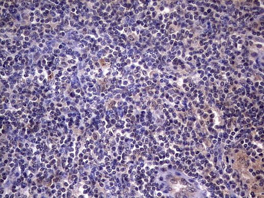 RTRAF Antibody in Immunohistochemistry (Paraffin) (IHC (P))