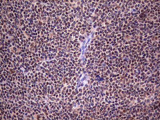 C14orf166 Antibody in Immunohistochemistry (Paraffin) (IHC (P))