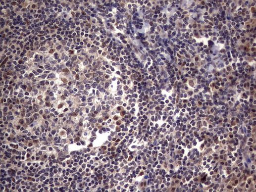 RTRAF Antibody in Immunohistochemistry (Paraffin) (IHC (P))