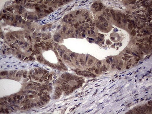 C14orf166 Antibody in Immunohistochemistry (Paraffin) (IHC (P))