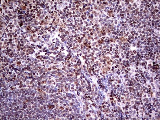 RTRAF Antibody in Immunohistochemistry (Paraffin) (IHC (P))