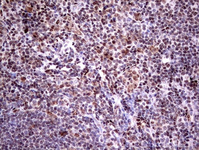 RTRAF Antibody in Immunohistochemistry (Paraffin) (IHC (P))