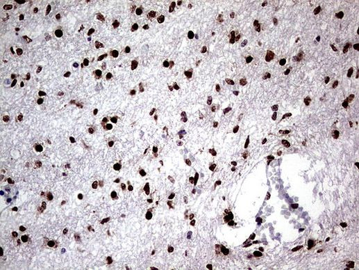 RTRAF Antibody in Immunohistochemistry (Paraffin) (IHC (P))