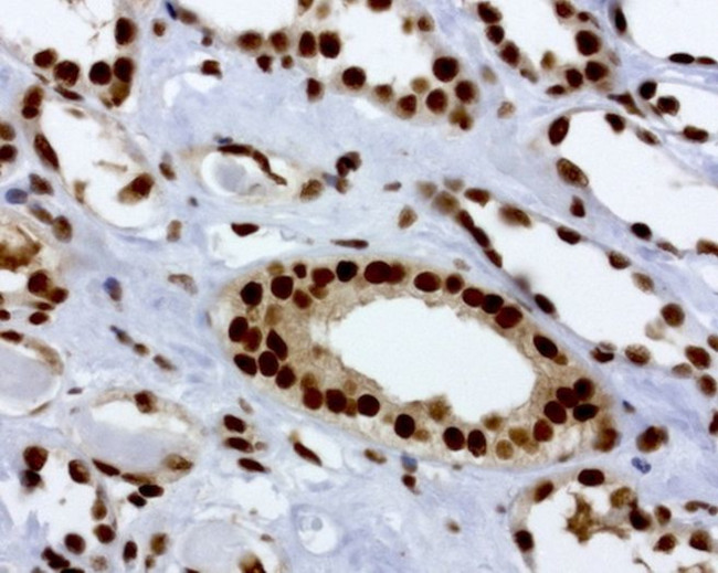 RTRAF Antibody in Immunohistochemistry (Paraffin) (IHC (P))