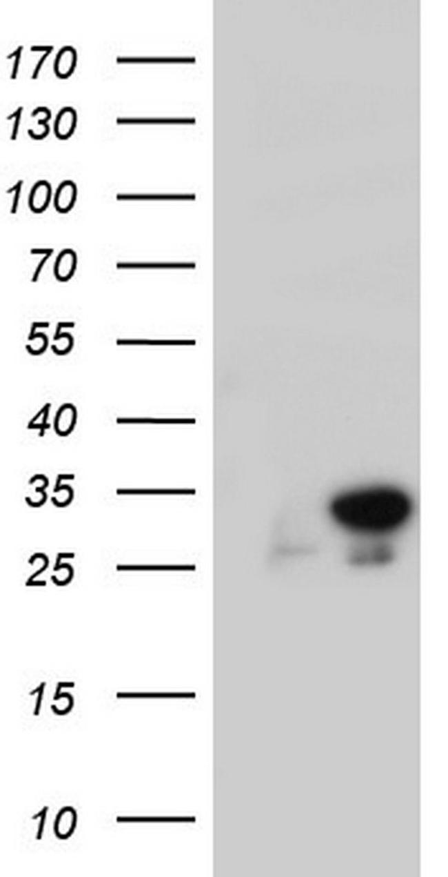 RTRAF Antibody in Western Blot (WB)