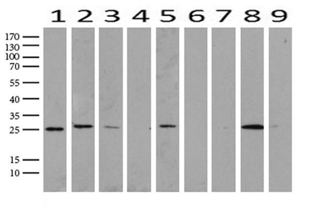 RTRAF Antibody in Western Blot (WB)