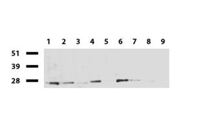 RTRAF Antibody in Western Blot (WB)