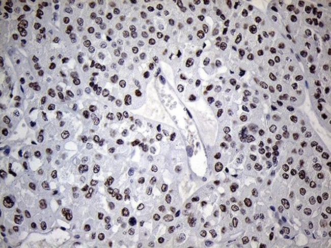 C14orf80 Antibody in Immunohistochemistry (Paraffin) (IHC (P))