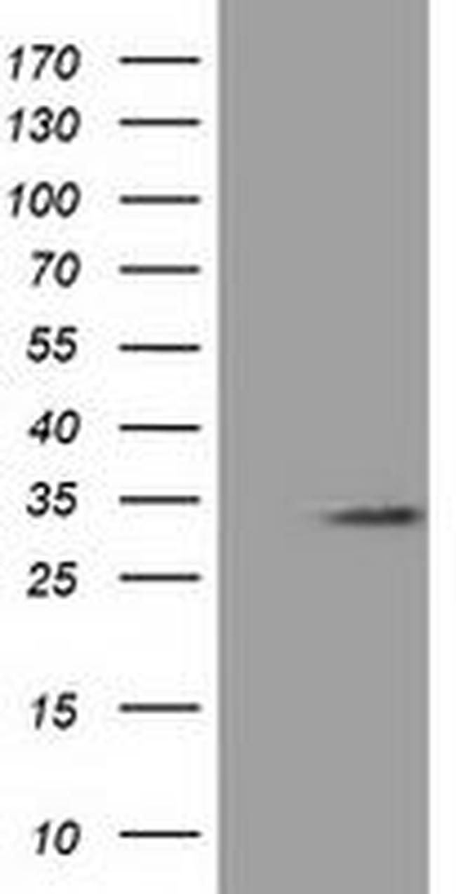 C16orf72 Antibody in Western Blot (WB)