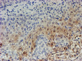 C17orf37 Antibody in Immunohistochemistry (Paraffin) (IHC (P))