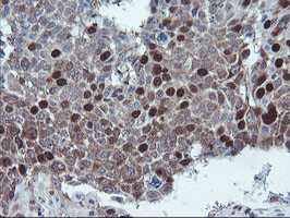 C17orf37 Antibody in Immunohistochemistry (Paraffin) (IHC (P))