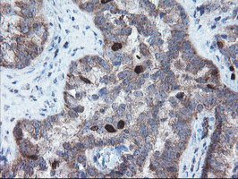 C17orf37 Antibody in Immunohistochemistry (Paraffin) (IHC (P))