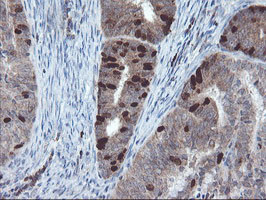 C17orf37 Antibody in Immunohistochemistry (Paraffin) (IHC (P))