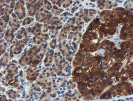 C17orf37 Antibody in Immunohistochemistry (Paraffin) (IHC (P))