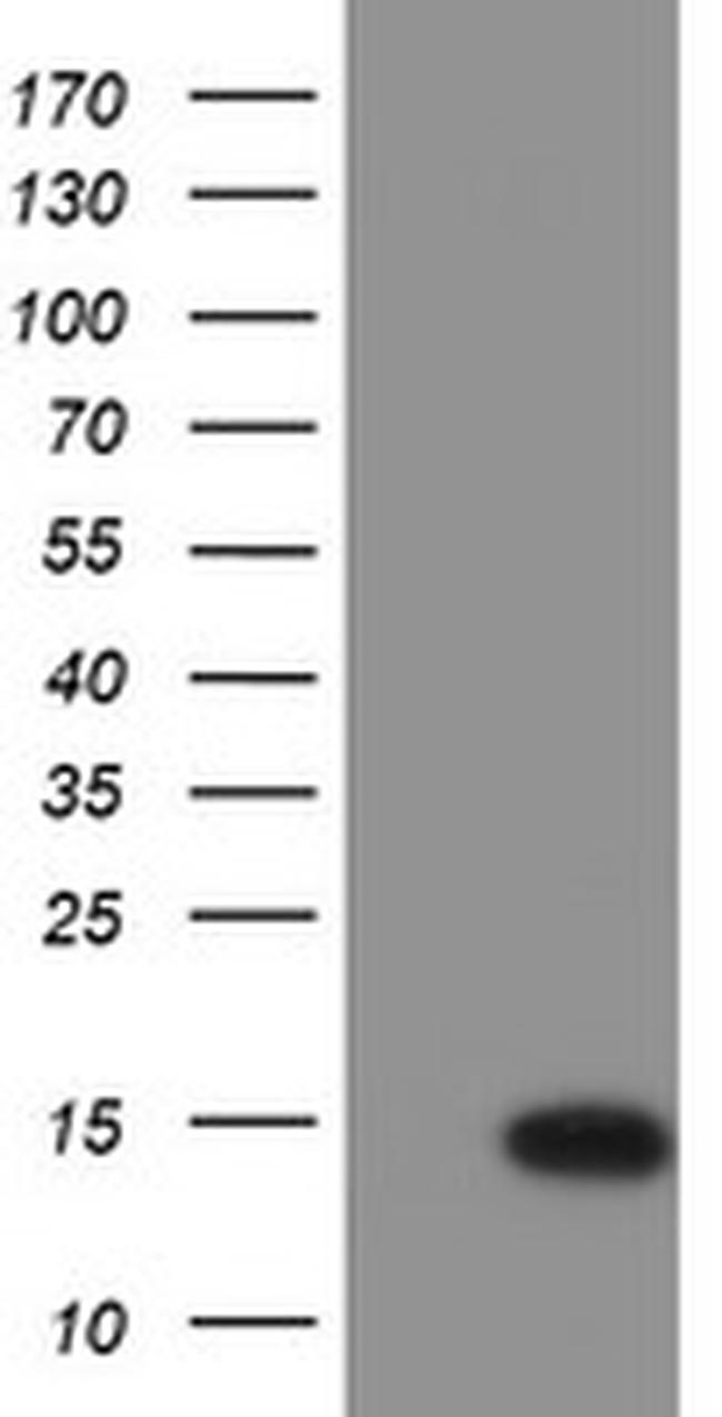 C17orf37 Antibody in Western Blot (WB)