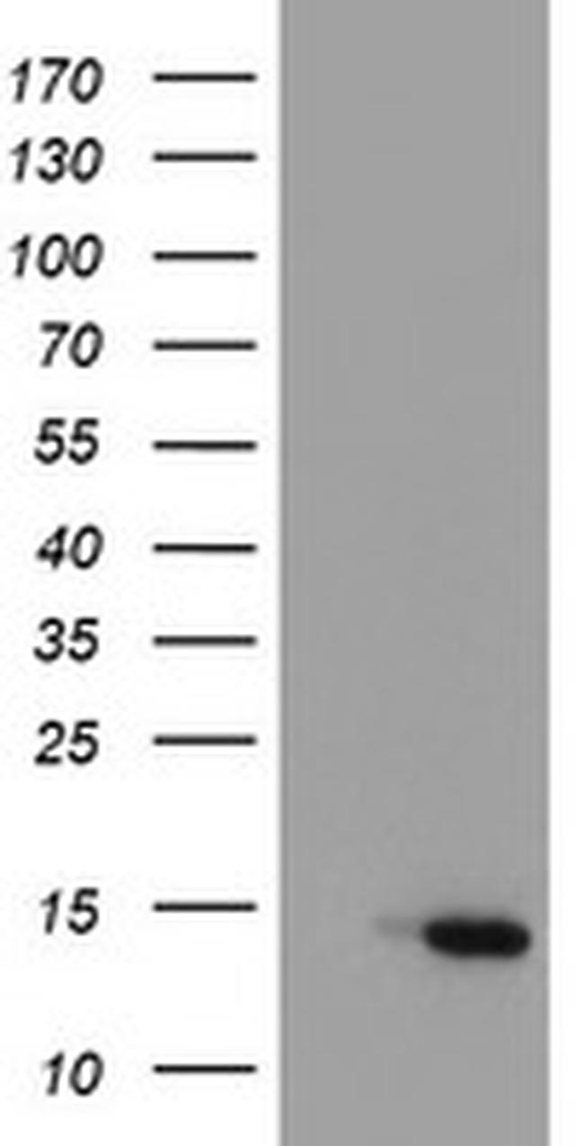 C17orf37 Antibody in Western Blot (WB)