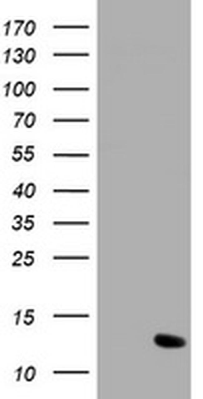 C17orf37 Antibody in Western Blot (WB)