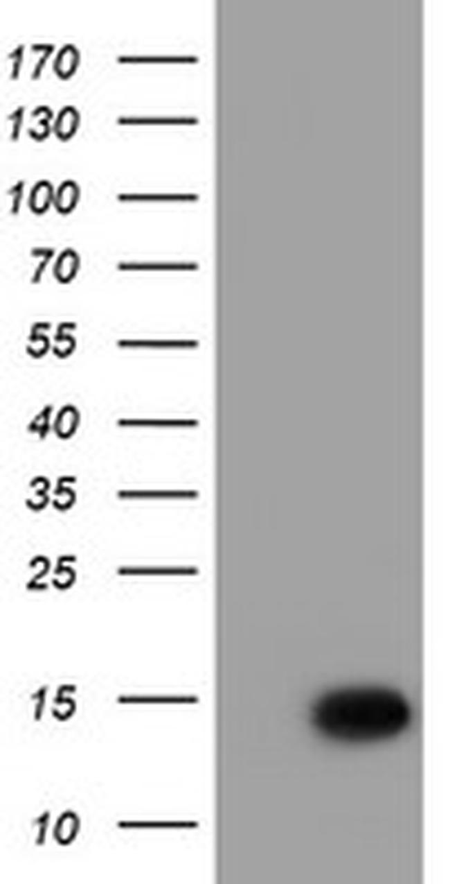 C17orf37 Antibody in Western Blot (WB)