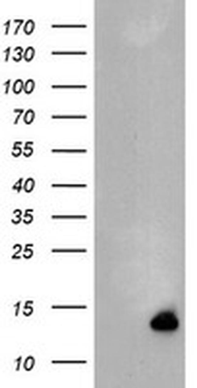 C17orf37 Antibody in Western Blot (WB)