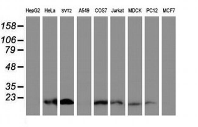 C17orf37 Antibody in Western Blot (WB)