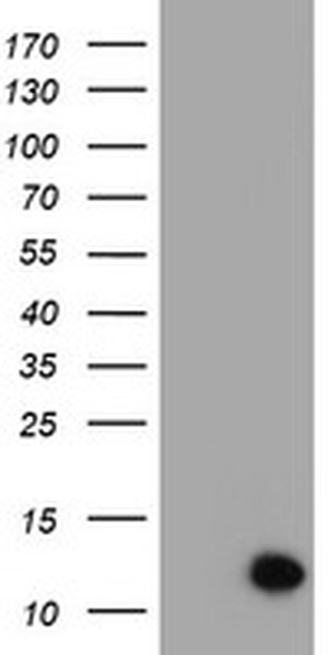 C17orf37 Antibody in Western Blot (WB)