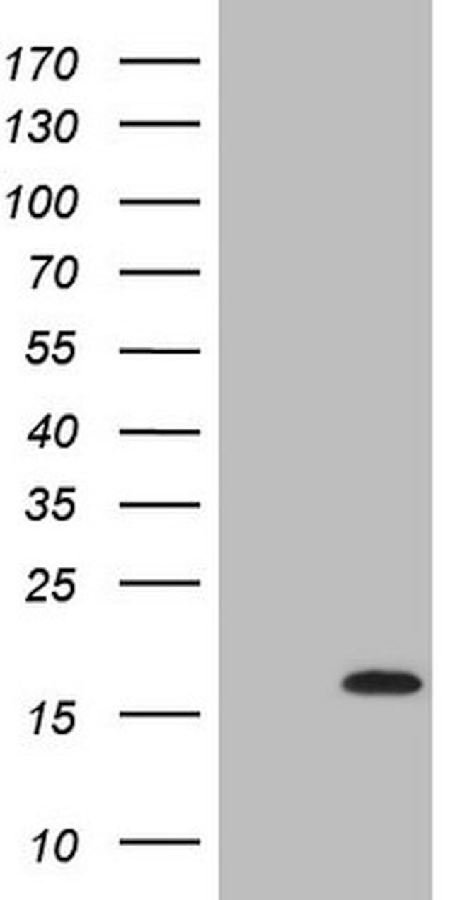 C17orf58 Antibody in Western Blot (WB)