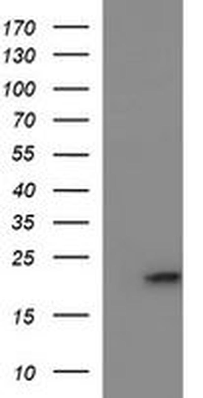 C17orf62 Antibody in Western Blot (WB)