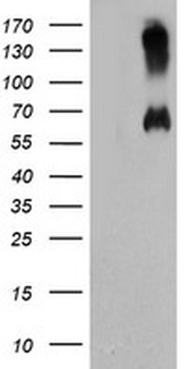 C18orf8 Antibody in Western Blot (WB)