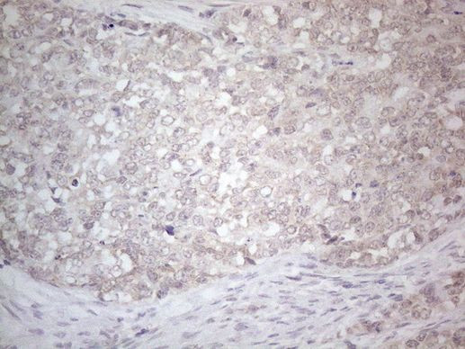 C19ORF80 Antibody in Immunohistochemistry (Paraffin) (IHC (P))