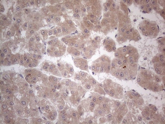 C19ORF80 Antibody in Immunohistochemistry (Paraffin) (IHC (P))