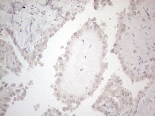 C19ORF80 Antibody in Immunohistochemistry (Paraffin) (IHC (P))