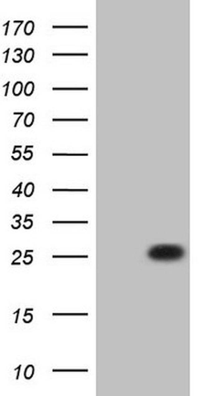 C19ORF80 Antibody in Western Blot (WB)