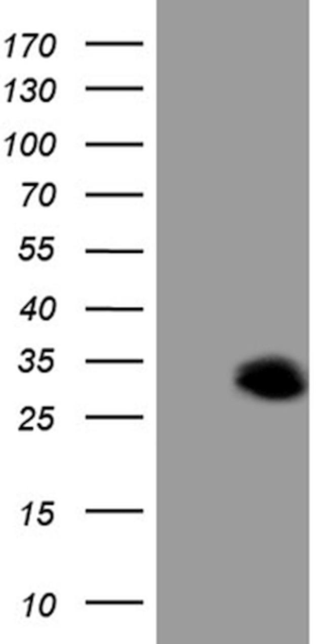 C19ORF80 Antibody in Western Blot (WB)