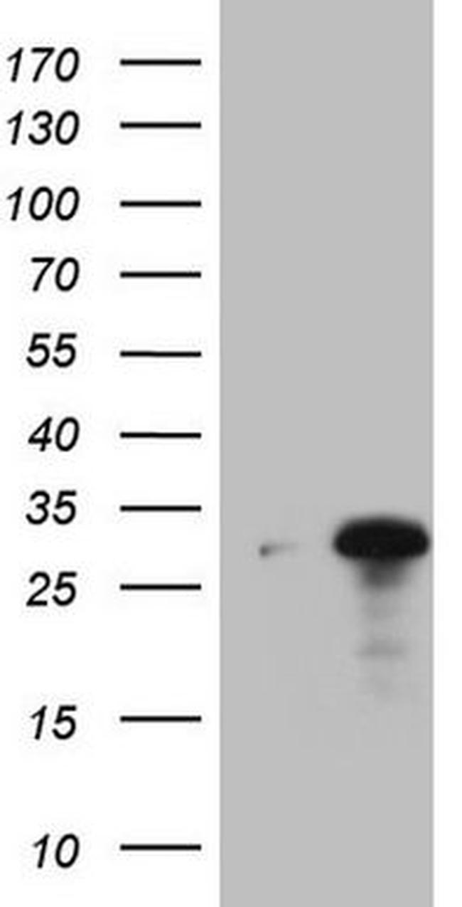 C19ORF80 Antibody in Western Blot (WB)