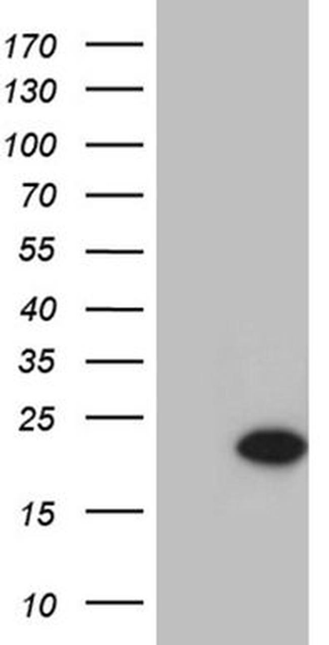 C1D Antibody in Western Blot (WB)