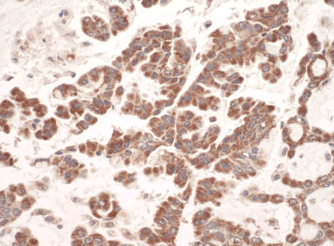 C1QBP Antibody in Immunohistochemistry (IHC)