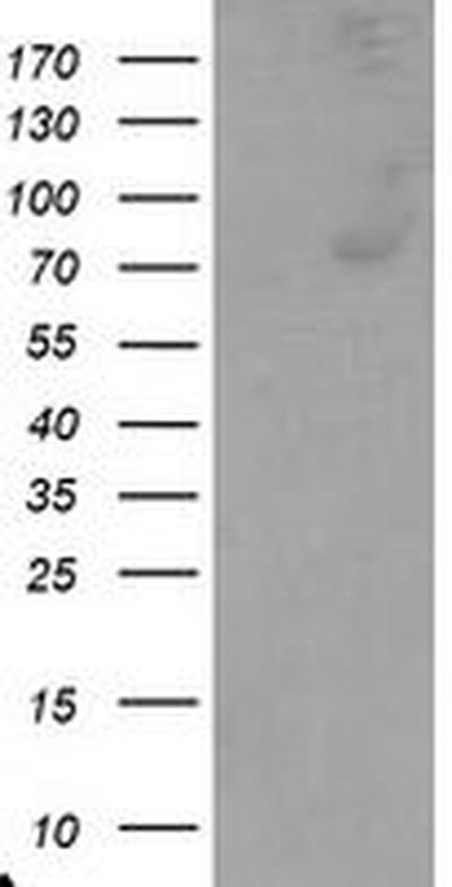 C1R Antibody in Western Blot (WB)