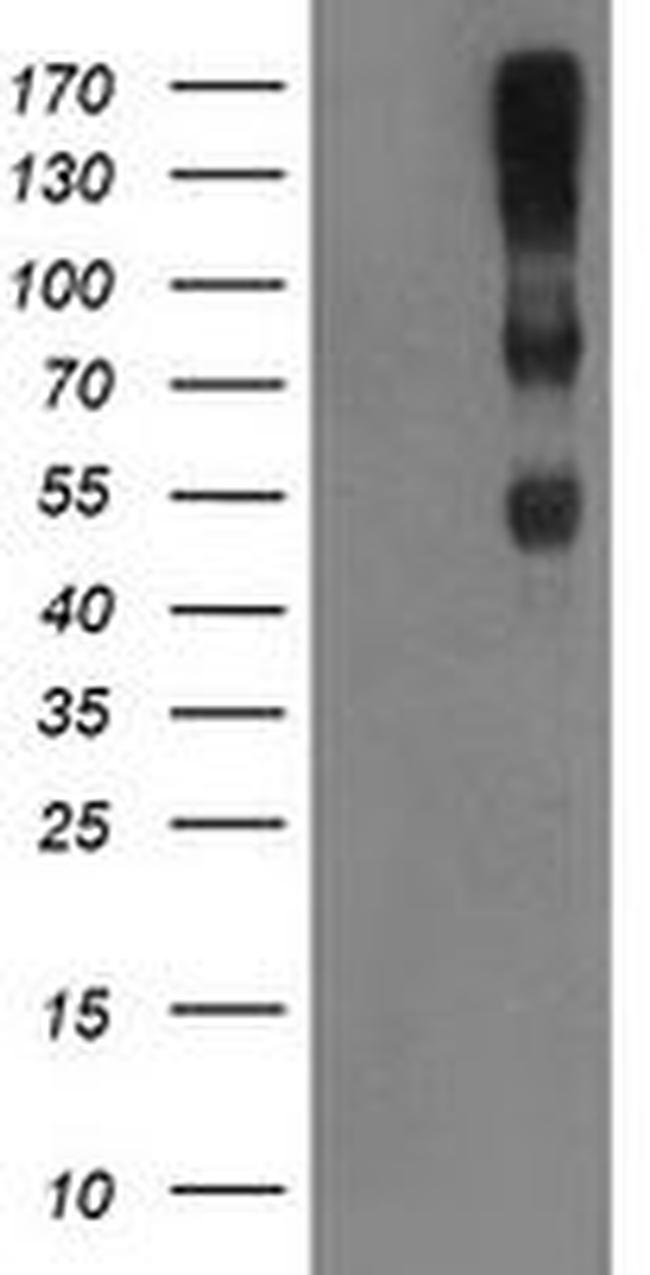 C1R Antibody in Western Blot (WB)