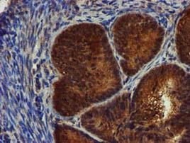 C1S Antibody in Immunohistochemistry (Paraffin) (IHC (P))