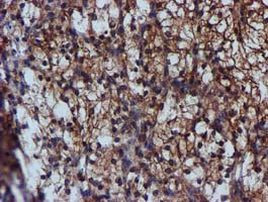 C1S Antibody in Immunohistochemistry (Paraffin) (IHC (P))