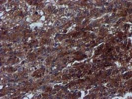 C1S Antibody in Immunohistochemistry (Paraffin) (IHC (P))